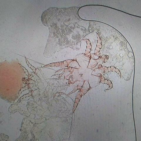 Ear Mite
