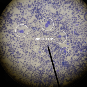 Cancerous cells